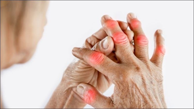 Râu mèo có tác dụng điều trị thấp khớp