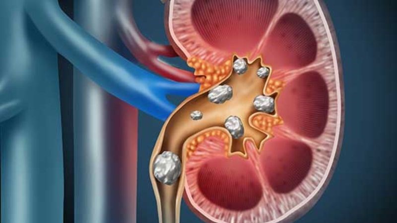 Râu mèo có thể được sử dụng để trị sỏi tiết niệu