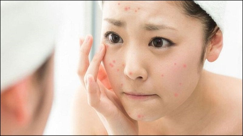 Sau khi kiểm tra, nếu da bị mẩn đỏ th&igrave; bạn kh&ocirc;ng n&ecirc;n tiếp tục d&ugrave;ng sản phẩm đ&oacute;