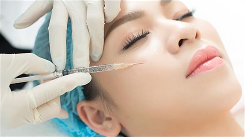 Tiêm filler là phương pháp xóa nếp nhăn mắt hiệu quả nhưng tốn kém