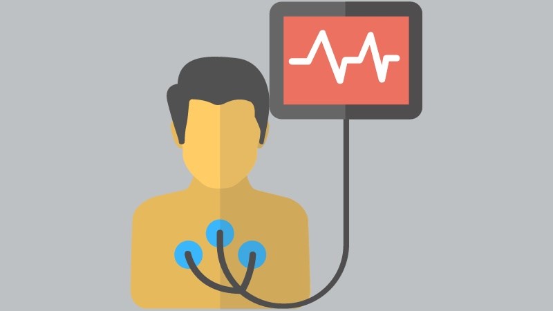 Đo điện tâm đồ là xét nghiệm không thể thiếu trong chẩn đoán nhịp tim nhanh