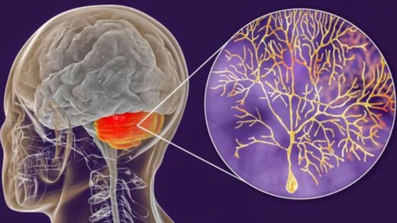 Tế bào thần kinh Purkinje ảnh hưởng đến khả năng chuyển động của cơ thể