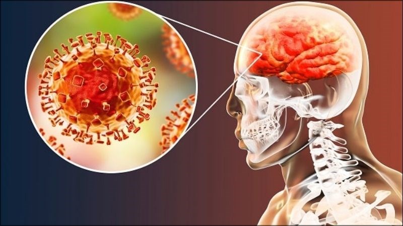 Nipah là một tác nhân gây ra căn bệnh phù não cực kỳ nguy hiểm
