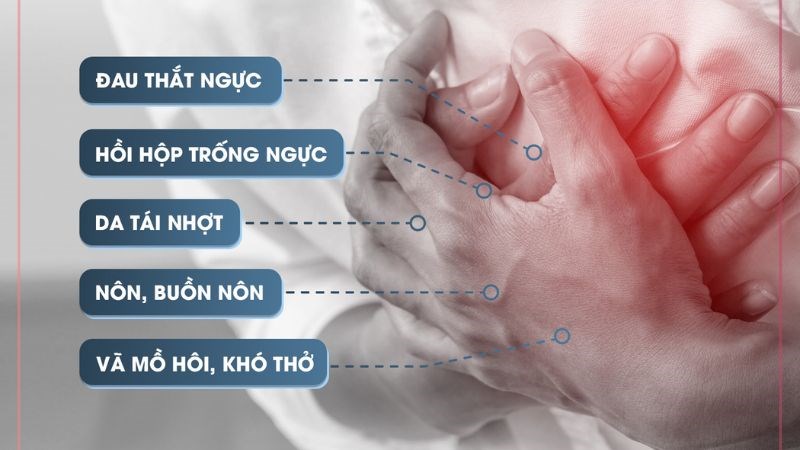 Đau thắt ngực là triệu chứng điển hình của nhồi máu cơ tim