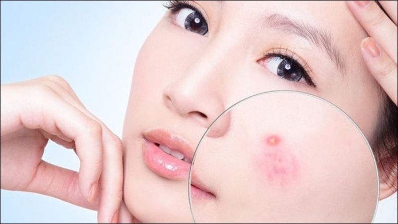 Kết hợp vitamin C và Kẽm giúp kích thích làm lành vết thương nhanh hơn