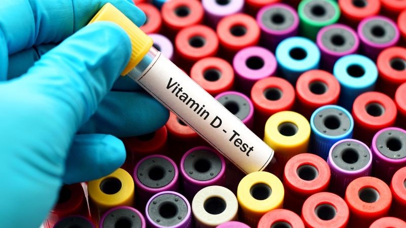 Bạn nên đi xét nghiệm vitamin D nếu gặp những tình trạng sức khoẻ như trên