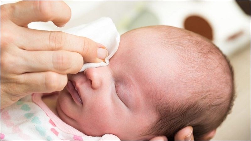 Chườm ấm lên mắt để giảm tình trạng sưng tấy và kích ứng Chườm ấm lên mắt để giảm tình trạng sưng tấy và kích ứng