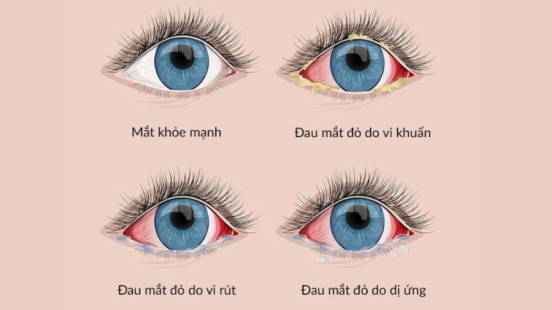 T&ugrave;y v&agrave;o c&aacute;c t&aacute;c nh&acirc;n g&acirc;y bệnh m&agrave; thời gian khỏi bệnh cũng kh&aacute;c nhau