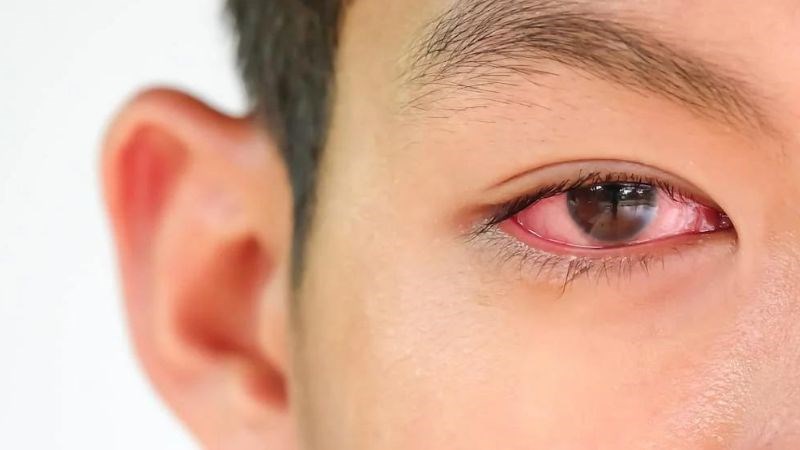 Bố mẹ cần cho trẻ hạn chế việc tiếp x&uacute;c với người đang hoặc nghi ngờ mắc bệnh