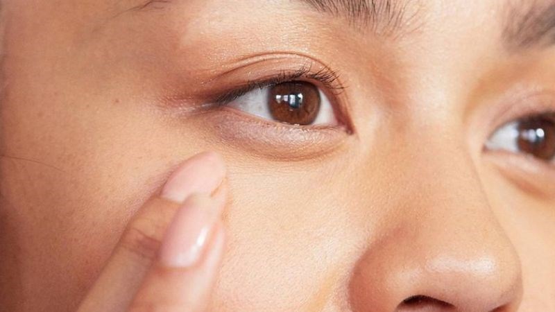 Vitamin C giúp loại bỏ chất độc hại tích tụ dưới da nên giảm bọng mắt