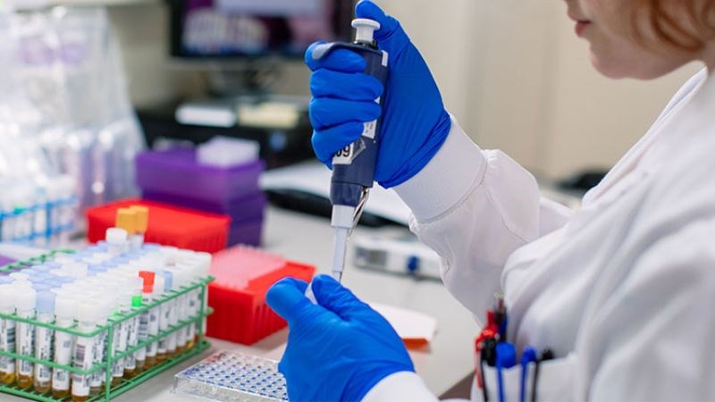 Xét nghiệm sinh học phân tử để xác định liệu có nhiễm virus đậu mùa khỉ hay không