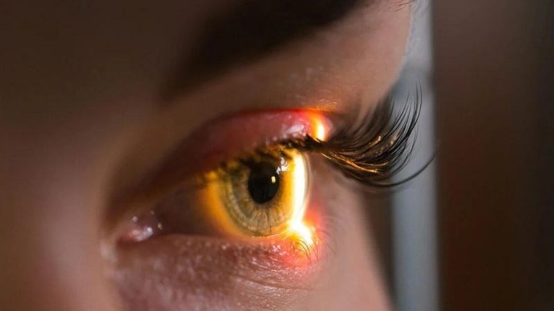 Laser là biện pháp điều trị có độ chính xác cao