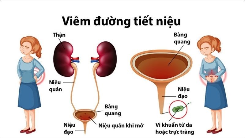 3. Phương Pháp Điều Trị Khi Thuốc Không Hiệu Quả