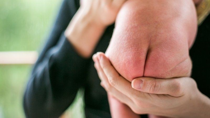 Hăm tã khiến trẻ cảm thấy bứt rứt, không ngủ được