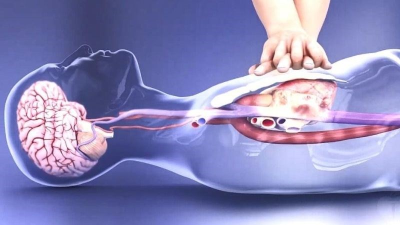 Tim đập nhanh quá mức gây nên tình trạng tim ngừng đập đột ngột