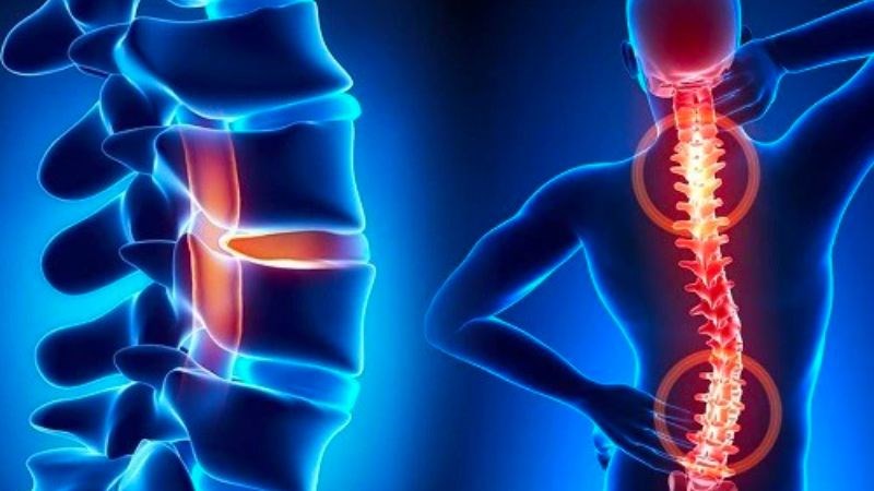 Khương Thảo Đan có khả năng hỗ trợ trong việc điều trị bệnh xương khớp