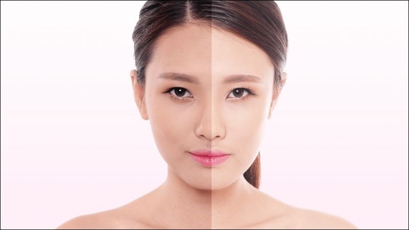 Thời tiết mùa hè khiến làn da dễ bị sạm màu