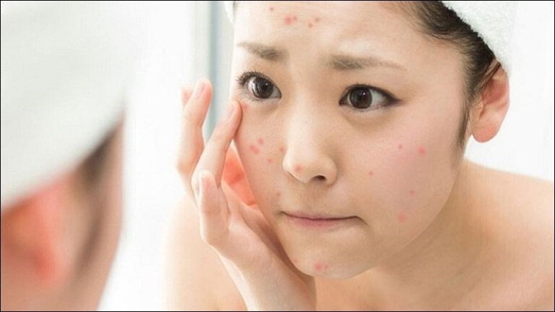 Đắp mặt nạ nhiều có thể gây quá tải và kích ứng da