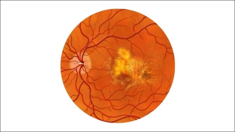 Vitamin A và lutein trong cà rốt có tác dụng trong việc giảm nguy cơ thoái hóa điểm vàng
