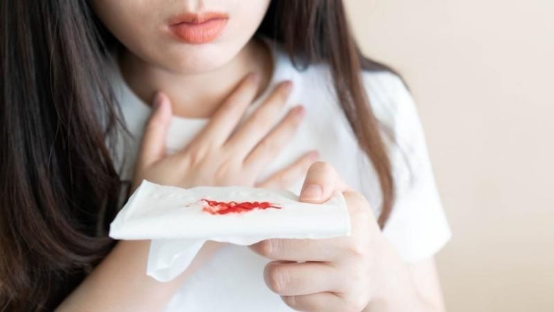 Khi xuất hiện ho ra máu nên đến các cơ sở y tế để được thăm khám