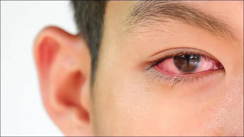 Thuốc nhỏ mắt V.Rohto gi&uacute;p l&agrave;m giảm sưng, đỏ v&agrave; ngứa mắt