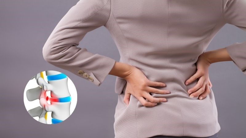 Thoát vị đĩa đệm gây đau lưng do phần nhân mềm bị lệch khỏi vị trí