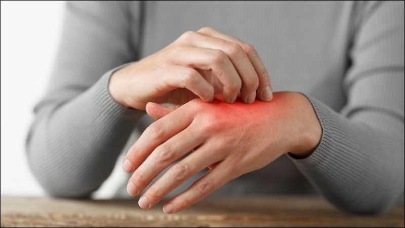 Khi ớt tiếp xúc với da có thể gây ra cảm giác bỏng rát, viêm da