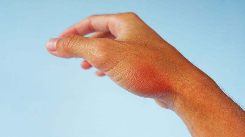 Chất capsaicin trong quả ớt có khả năng chống viêm