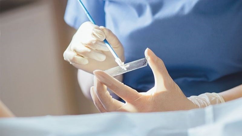 Xét nghiệm dịch âm đạo để tìm nguyên nhân gây bệnh