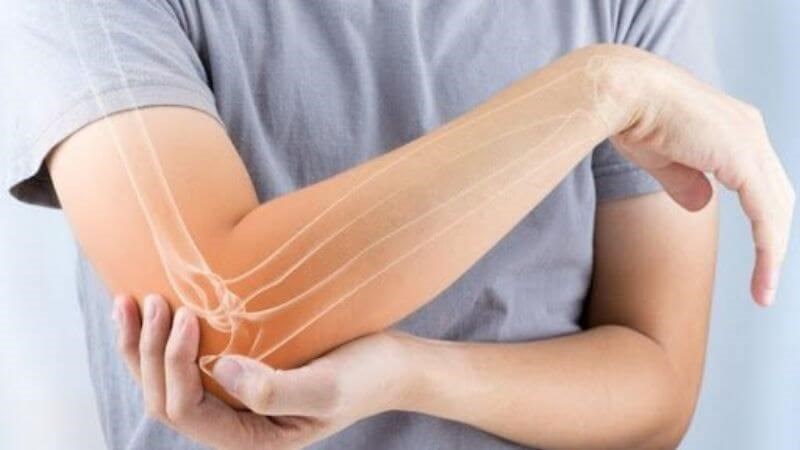 Viêm gân là tình trạng gân xuát hiện tình trạng sưng bất thường