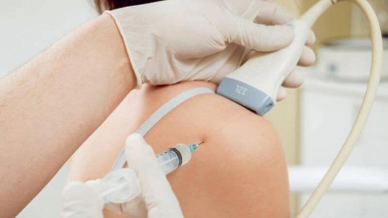 Tiêm corticoid vào khớp để giảm tình trạng viêm