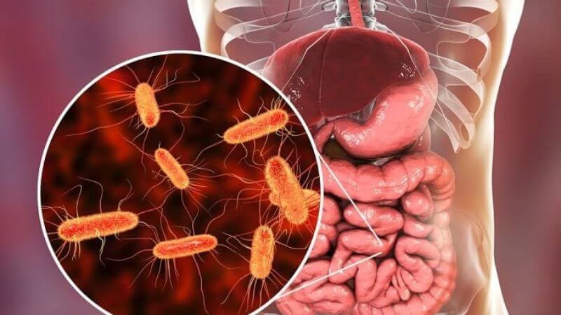 Vi khuẩn thường là nguyên nhân khiến ruột bị viêm