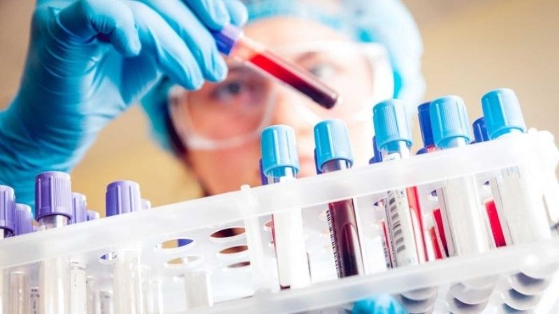 Làm xét nghiệm máu để chẩn đoán viêm tụy mạn