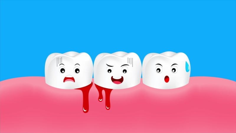 Bệnh dễ gây ra tình trạng chảy máu chân răng