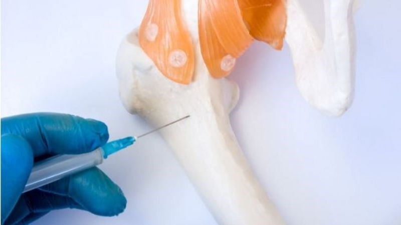 Tủy đồ là một trong những xét nghiệm chẩn đoán chính xác tình trạng bệnh