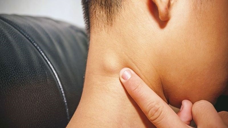 Viêm hạch bạch huyết có thể gây ra các biến chứng 