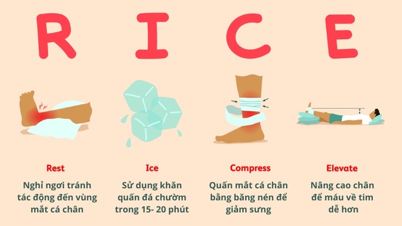 Tự xử trí bong mắt cá chân tại nhà bằng phương pháp RICE