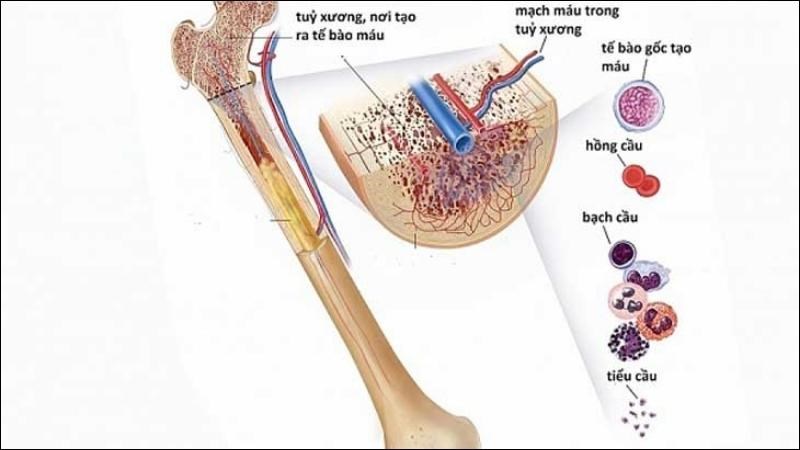 Bệnh Thiếu Máu Bất Sản: Tìm Hiểu Nguyên Nhân, Triệu Chứng và Điều Trị