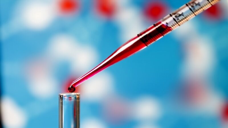 Xét nghiệm máu giúp chẩn đoán tê phù do thiếu vitamin B1 Xét nghiệm máu giúp chẩn đoán tê phù do thiếu vitamin B1