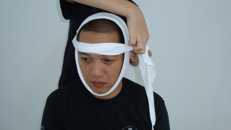 Bạn có thể quấn băng vòng từ cằm lên đầu để cố định xương hàm