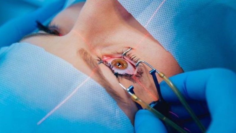 Phẫu thuật cắt bỏ dịch kính để giảm áp lực của mắt