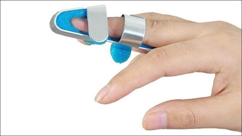 Người bệnh cần nẹp cố định ngón tay từ vài ngày đến vài tuần