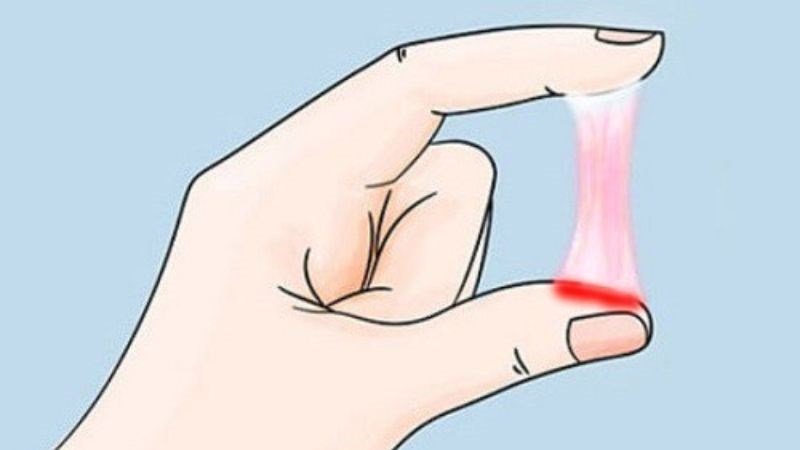 Âm đạo ra khí hư bất thường là dấu hiệu của viêm nội mạc tử cung