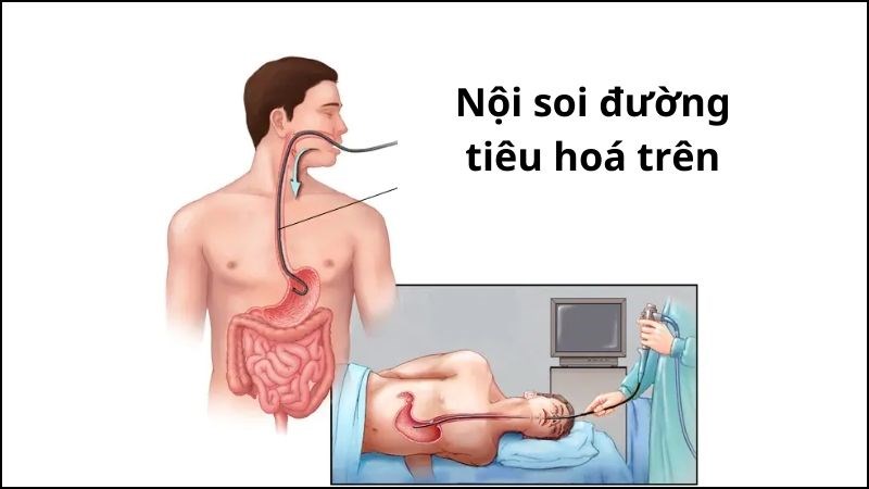 Nội soi giúp đánh giá tình hình bệnh