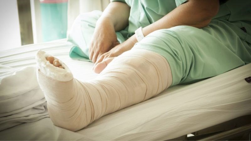 Bó bột cố định là biện pháp điều trị phổ biến nhất trong điều trị gãy xương