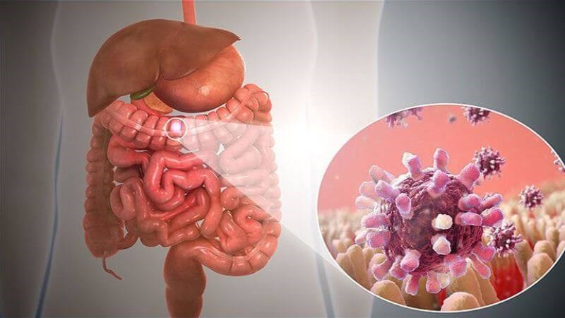 Virus là nguyên nhân hay gặp gây viêm dạ dày ruột