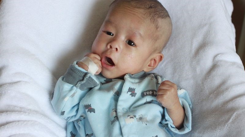 Trẻ bị thiếu máu tán huyết di truyền cần truyền máu nhiều đợt và phòng yếu tố gây tan máu