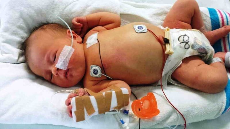Cơn tan máu cấp nặng có thể gây suy đa tạng như suy tim, suy thận