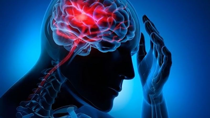 Bệnh não gan là tình trạng rối loạn chức năng não do suy chức năng gan