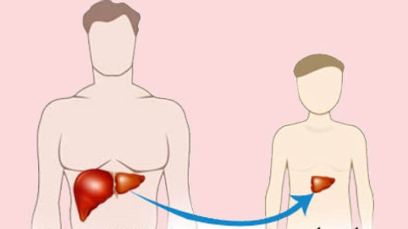Người ghép tạng có nguy cơ mắc bệnh lớn hơn những người khác